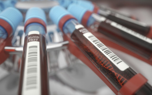 FDA blocks much-anticipated BioMarin hemophilia gene therapy